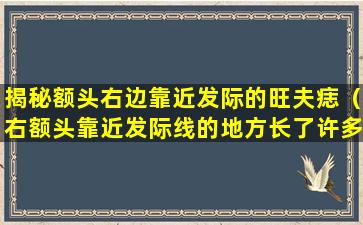 揭秘额头右边靠近发际的旺夫痣（右额头靠近发际线的地方长了许多痘痘）